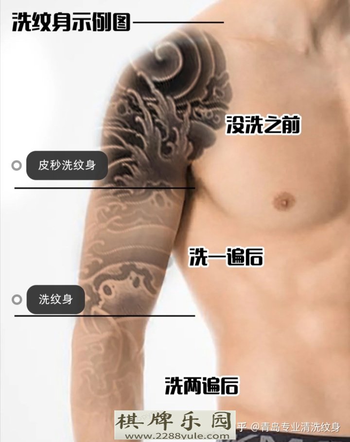 洗纹身常见问题解答汇总bbin平台官网